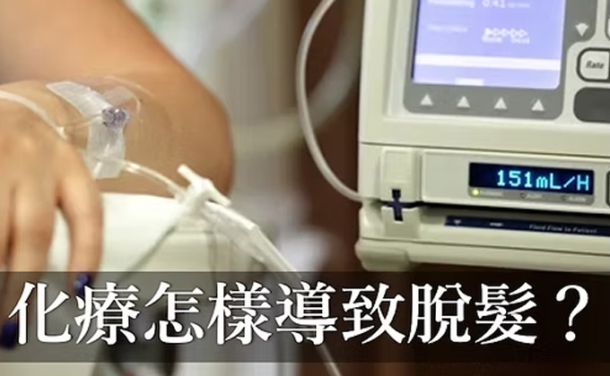 化療怎樣導致脫髮？