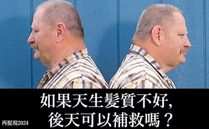 如果天生髮質不好，後天可以補救嗎？